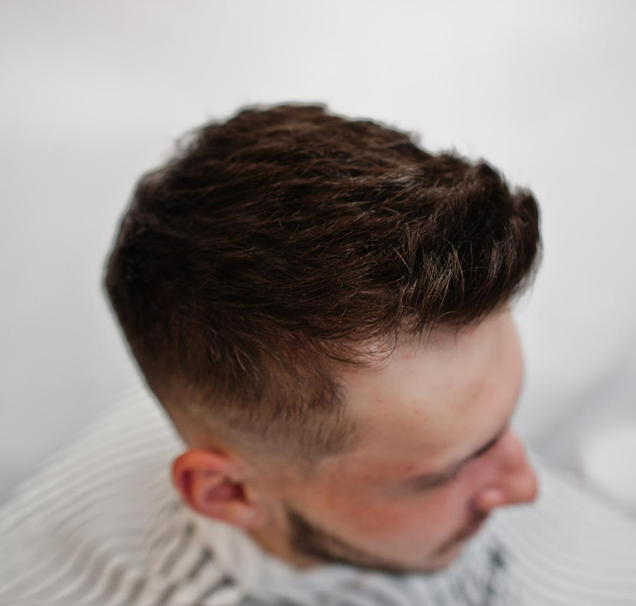 Ankara Protez Saç Merkezi